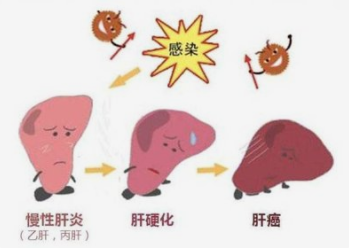 得过肝炎的人会传染吗，会不会影响生育