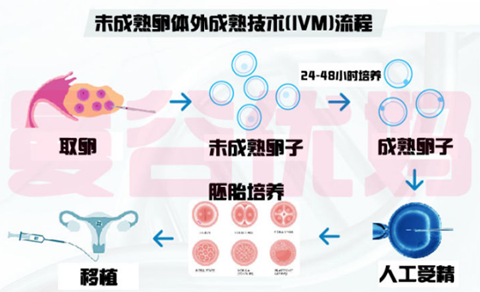 ivm技术到底是什么？和传统试管婴儿技术